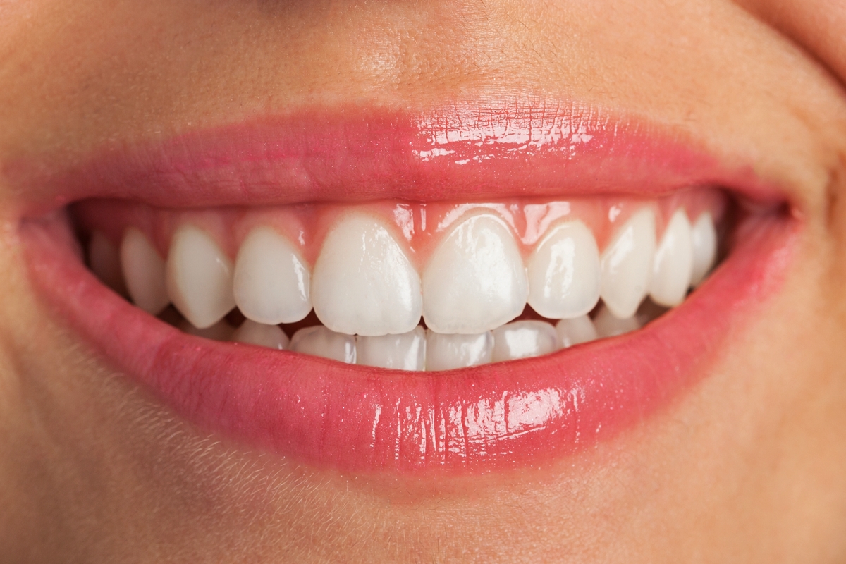 Joia nos dentes: dentista alerta sobre risco de tendência entre influencers