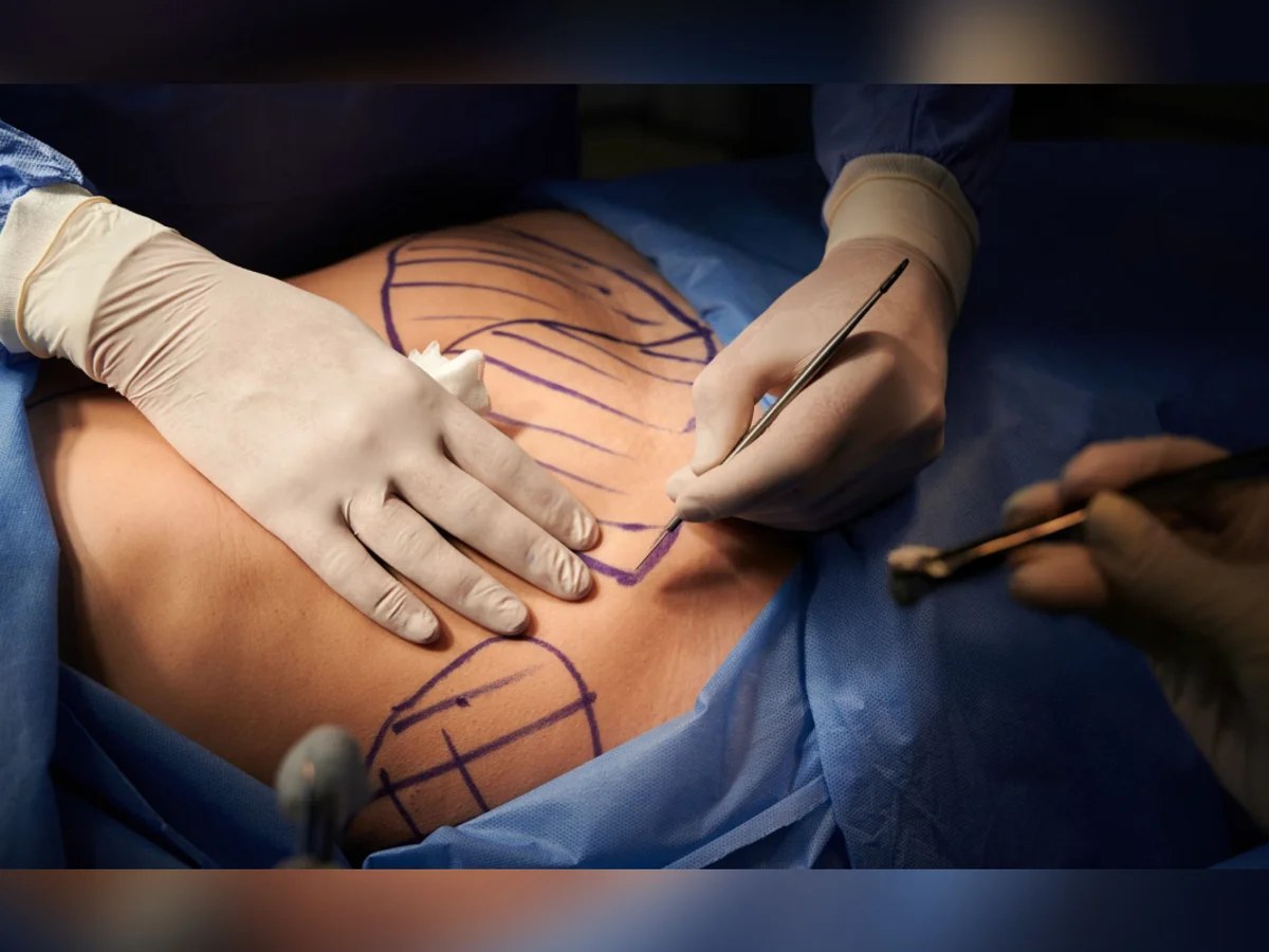 Justiça suspende médico de BH investigado por possíveis erros em cirurgias