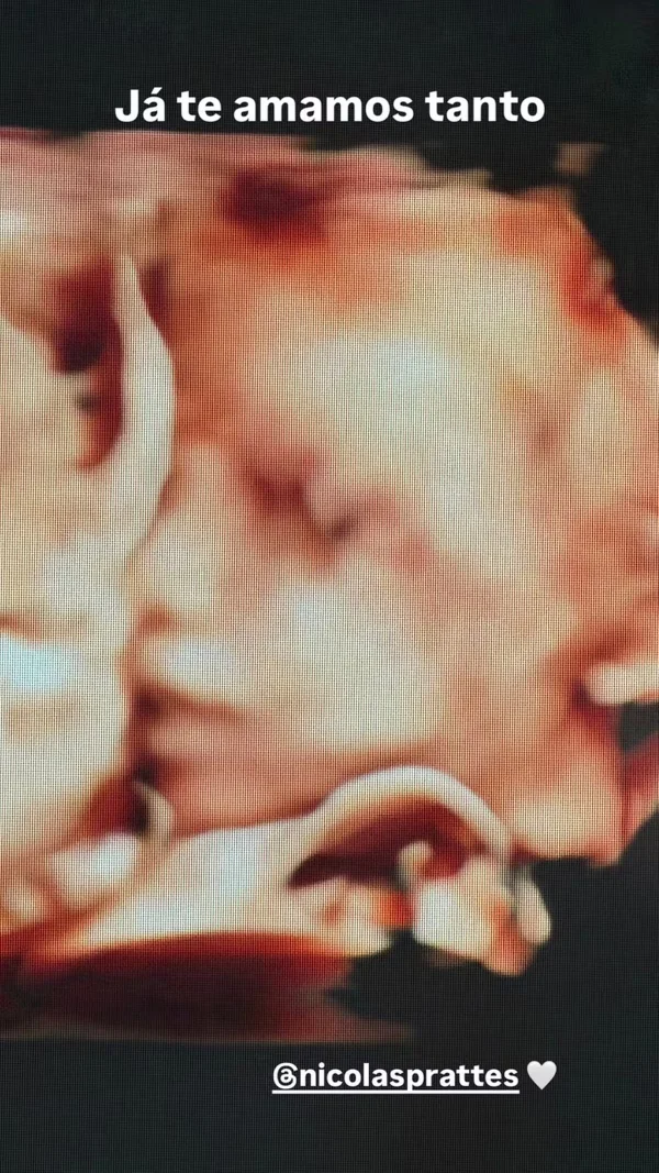 Sabrina Sato mostra rosto do filho em ultrassom 3D. Veja foto