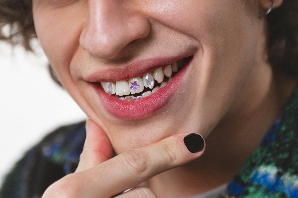 Joia nos dentes: dentista alerta sobre risco de tendência entre influencers
