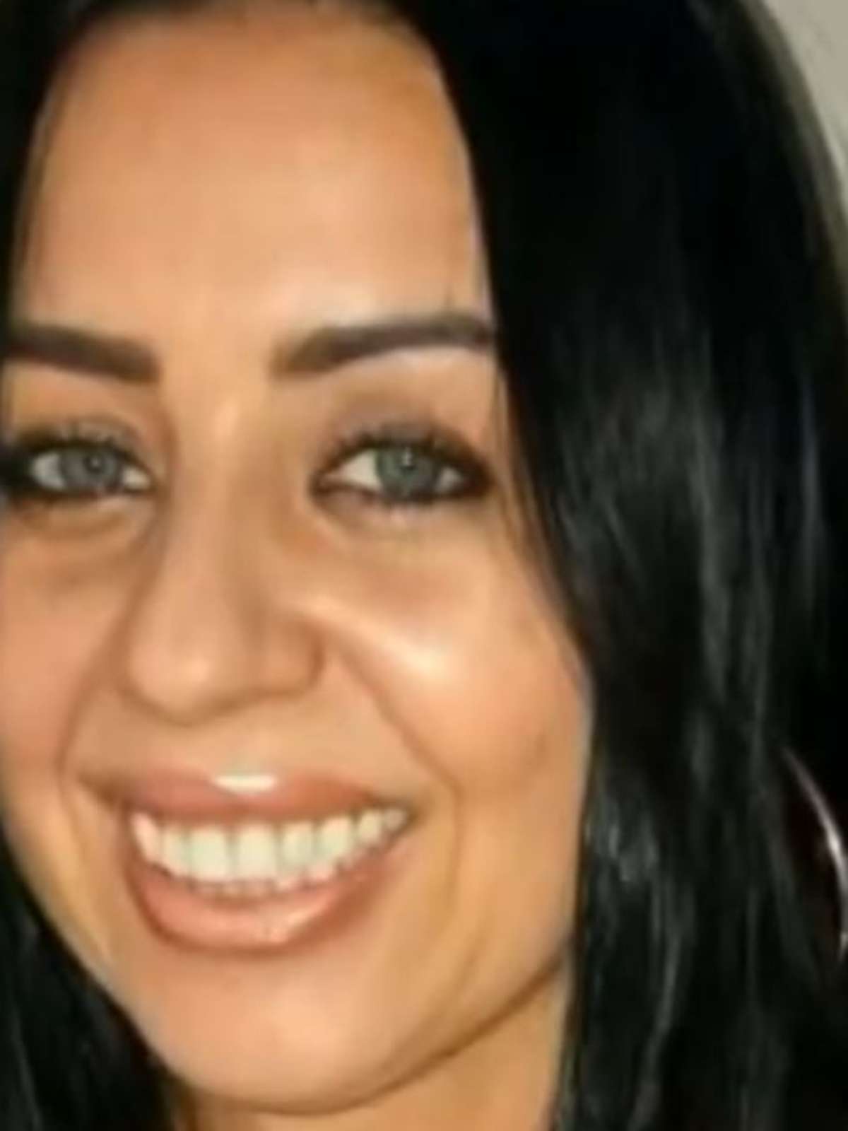 Polícia investiga morte de professora após injeção para tratar queda de cabelo no DF